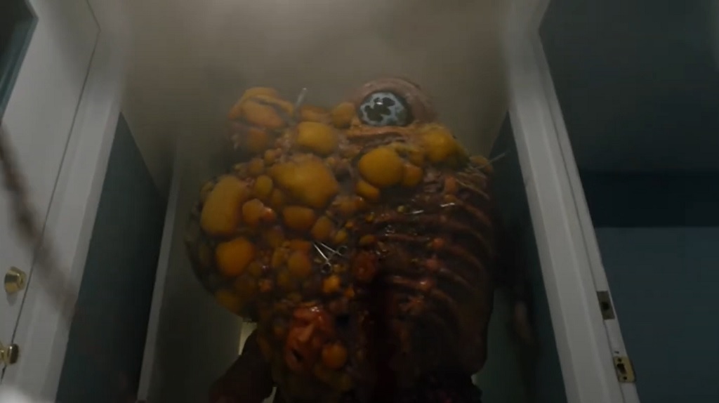 Teaser per Cyst: una mostruosa cisti prende vita e semina morte in clinica cyst film horror 2020